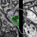 The machine prediction for a subject containing an imaging artefact