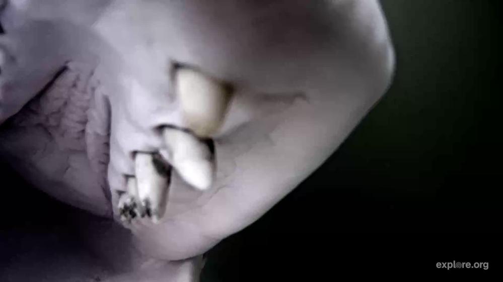 20828885 -cavities.jpeg